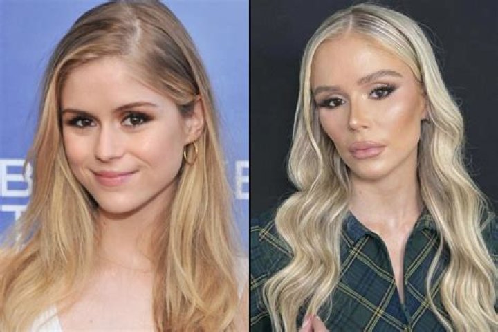 What To Know About Ariela Weinberg's Plastic Surgery Rumors